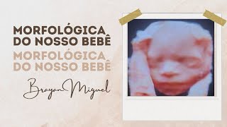 Morfológica do nosso bebê 👶🏽 [upl. by Nylrebmik3]