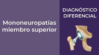 Diagnóstico Diferencial Mononeuropatías miembro superior [upl. by Marcelline]