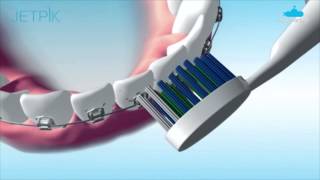 Irrigador Oral com Fio Dental Jetpik JP50  Submarinocombr [upl. by Asehr]