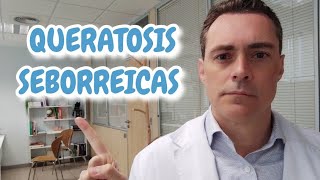 Dermatólogo explica lo que debes conocer sobre las queratosis seborreicas [upl. by Yeca381]