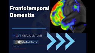 Frontotemporal Dementia [upl. by Eldrid625]