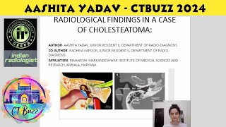 Aashita Yadav  Imaging Findings in Cholesteatoma ctbuzz [upl. by Avenej]