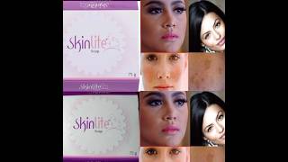 Skinlite Soap Review  Uses and Side Effects  कैसे यूज़ करे how to use skin light soap [upl. by Hampton12]