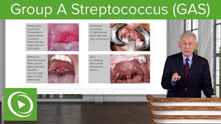 Group A Streptococcus GAS – Infectious Diseases  Lecturio [upl. by Abibah]