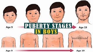 Puberty for boys stages 5 Things to Expect When Puberty Hits Boys [upl. by Aderf]