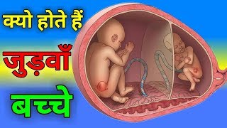 जुड़वाँ बच्चे क्यो होते हैं  Twins Baby Pregnancy Symptoms In Hindi  Conceiving twins  Pink Glow [upl. by Talley90]