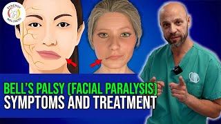 Bells Palsy Facial Paralysis Symptoms amp Treatment Options [upl. by Naira]