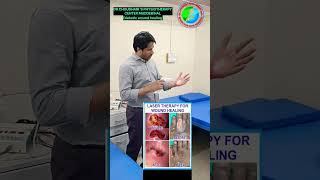 WOUND HEALING 😍 physiotherapy LASER shorts youtubeshorts video viralvideo woundhealing viral [upl. by Jesse]