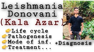 Leishmania donovani  life cycle  diagnosisTreatment etc Leishmania Leishmaniasis Parasitology [upl. by Mik699]