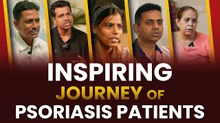 Inspiring Journey of Psoriasis Patients  Psoriasis Skin Disease  Dr Megha Chaturvedi [upl. by Aicad]