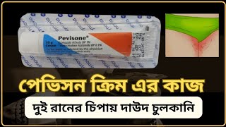 pevisone cream এর কাজ কি কি ভাবে ব্যাবহার করতে হয় দাউদ ও চুলকানি ওষুধ [upl. by Mavra783]