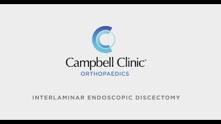 Interlaminar Endoscopic Discectomy at Campbell Clinic Orthopaedics [upl. by Raquela670]