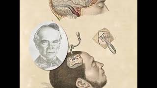 Historia de la medicina  Neurologia [upl. by Edla577]