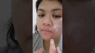 May 1st try of AVOQUIN CREAM on my face [upl. by Julienne260]