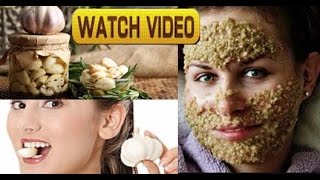 Garlic Face Mask For AcneBlackheadAntiAgeing  Beauty amp Health Benefits  Watch Till The End [upl. by Corabella]