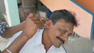 Letest ear cleaning by road side ear cleaner  satisfying ear cleaning with medicine  ear wax [upl. by Attebasile]