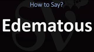 How to Pronounce Edematous CORRECTLY [upl. by Adnohr]