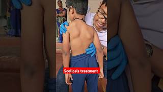 Scoliosis treatment drrajneeshkant worldfamouschiropractor [upl. by Aihsenrad]