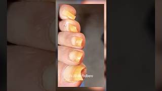 Nails satisfying pedicure shorts satisfying nails pedicure [upl. by Aillicirp490]