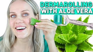 DERMAROLLING WITH ALOE VERA  affordable skin care routine [upl. by Petronilla]