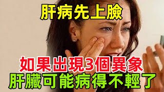 肝病先上臉，臉部如果出現3個異象，肝臟可能病得不輕了，需警惕健康常識養生保健健康健康飲食 [upl. by Wobniar]