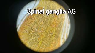 Spinal ganglia AG [upl. by Gnes]