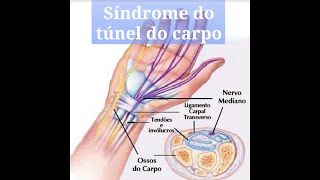 54 Teste para síndrome do túnel do carpo [upl. by Femmine]