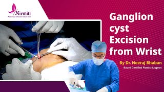 Ganglion Cysts Around The Knee  Everything You Need To Know  Dr Nabil Ebraheim [upl. by Korb]