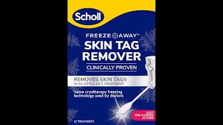 NEW Scholl Freeze Away Skin Tag Remover effectively removes skin tags in as little as 1 treatment [upl. by Tiertza]