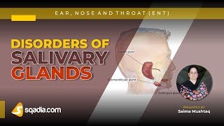 Disorders of Salivary Glands  Ear Nose Throat Lectures  Student Education  VLearning [upl. by Fadiman637]