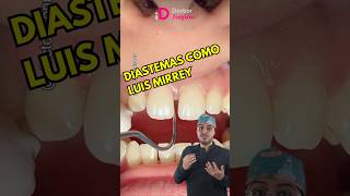 Diastemas espacios entre los dientes diastema brackets ortodoncia shorts dentista [upl. by Constance]