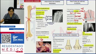 REPASO II  TRAUMATOLOGÍA [upl. by Maryrose622]