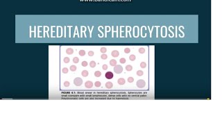 Hereditary Spherocytosis [upl. by Kerby632]