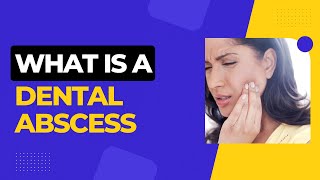 What is a Dental Abscess Causes and 3 Treatments Options [upl. by Lynette]