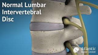 Normal Lumbar Intervertebral Disc [upl. by Booma243]