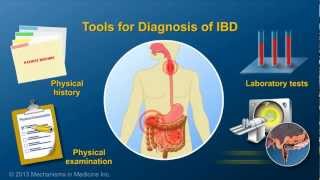 Diagnosing IBD [upl. by Elpmid97]