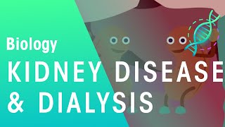 Kidney Disease and Dialysis  Health  Biology  FuseSchool [upl. by Bergmans549]