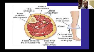 Rabdomiolisis en la emergencia Dr Gaston Keell [upl. by Ileek801]