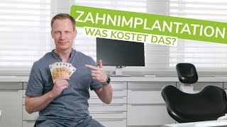 Was kosten Zahnimplantate Und wie viel muss ich für eine Zahnimplantation zahlen [upl. by Akers]