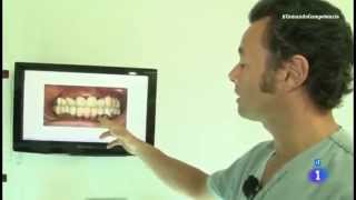 Reportaje  Precio y calidad de implantes dentales  Comando actualidad [upl. by Ymrots]