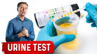 Urine Test Simplified [upl. by Loree788]