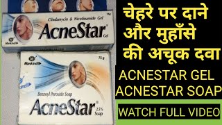 ACNESTAR GEL AND ACNESTAR SOAP REVIEW II ACNE PIMPLE CREAM AND ACNE PIMPLE SOAP [upl. by Mapel]