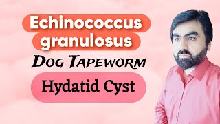 Lec15  Echinococcus granulosus  Hydatid Cyst  Life cycle  Cinical finding  Lab diagnosis Eng [upl. by Euqinommod484]