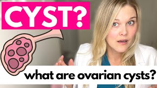 OVARIAN CYSTS What Causes Ovarian Cysts [upl. by Genet]