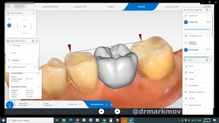 Cerec Primescan Measure Tool for Designing [upl. by Izak814]