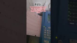 📈ecg heart beats cardiac function signal ytshorts video short [upl. by Sirhc910]