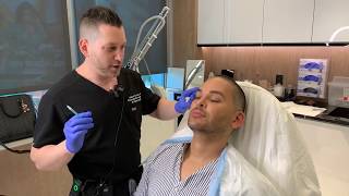 Botox and Dysport  Forehead Lines and Crows Feet  West Hollywood CA  Dr Jason Emer [upl. by Tiram]