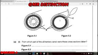 2024 FINAL EXAM PREPARATION DIGESTION [upl. by Edelstein677]