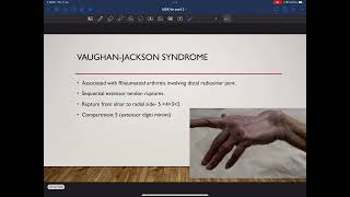 Musculoskeletal radiology lecture series PART 2 crack the core revision slides [upl. by Ymaj]