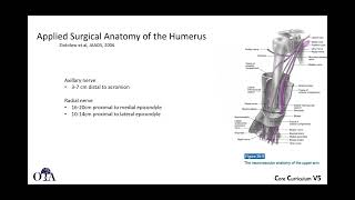 Humeral shaft fractures  1 of 4 [upl. by Kincaid]